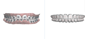 3d model of teeth